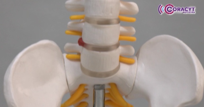 Alerta IMSS Tlaxcala sobre riesgos para la columna