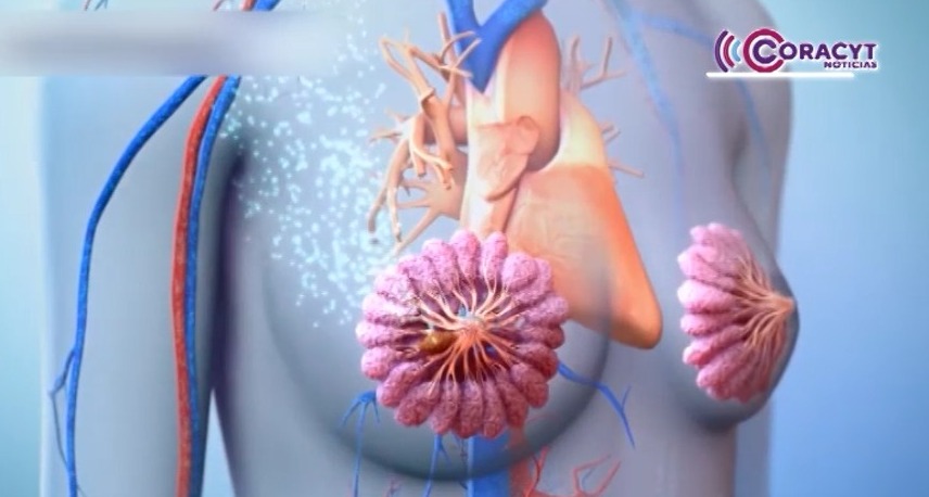 Persiste desinformación sobre el cáncer de mama, consideran tlaxcaltecas