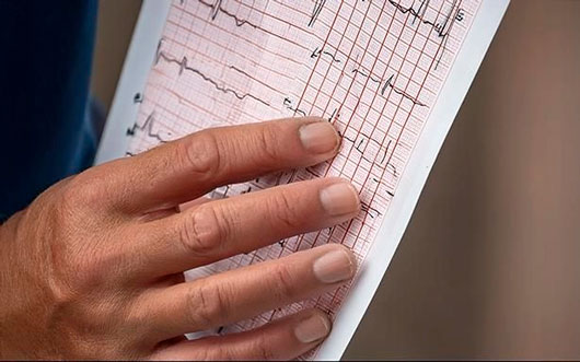 IMSS recomienda no consumir bebidas energéticas