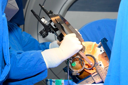 Marina introduce nuevas cirugías para tratar Parkinson en México