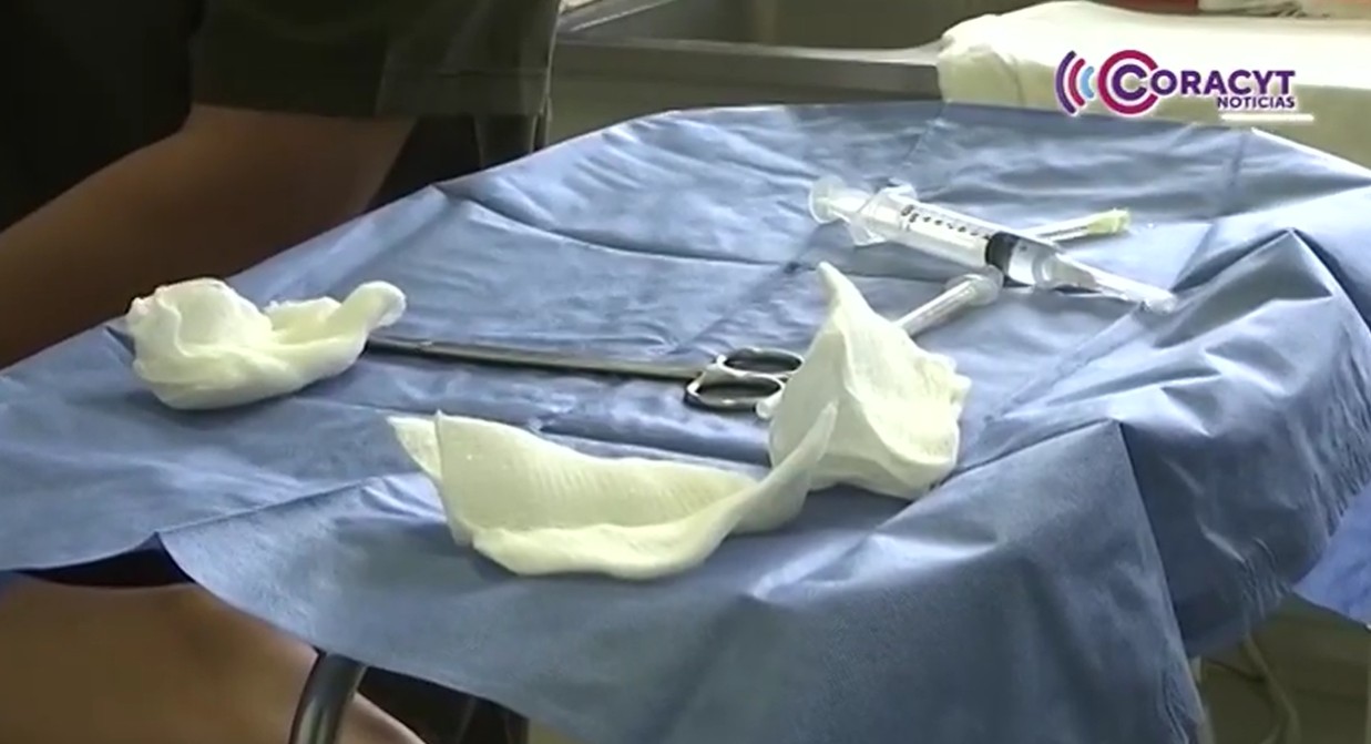 Habrá Jornadas de Vasectomía sin Bisturí en Calpulalpan, Apizaco, Tlaxcala y Huamantla