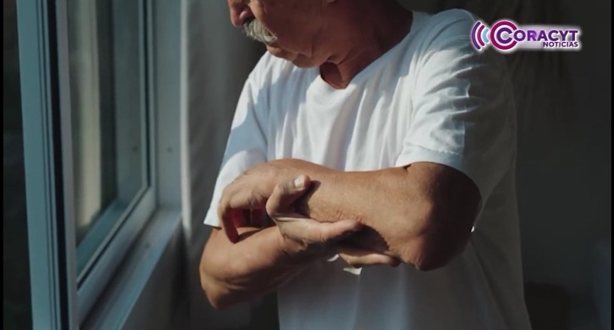 Aumentaron casos de Parkinson en Tlaxcala, reveló el Issste